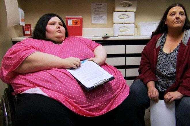 229 kiloqram arıqlayıb bu hala düşdü -  FOTOLAR